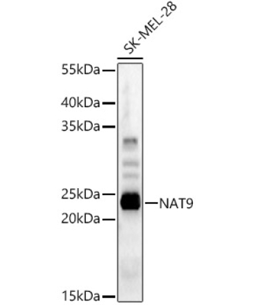 NAT9 Rabbit Polyclonal Antibody