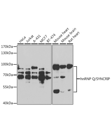 hnRNP Q/SYNCRIP Rabbit Polyclonal Antibody