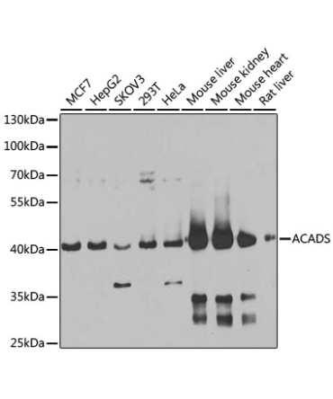 ACADS Rabbit Polyclonal Antibody