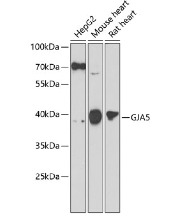 GJA5 Rabbit Polyclonal Antibody