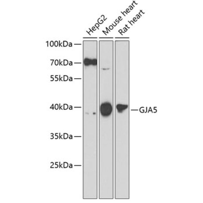 GJA5 Rabbit Polyclonal Antibody