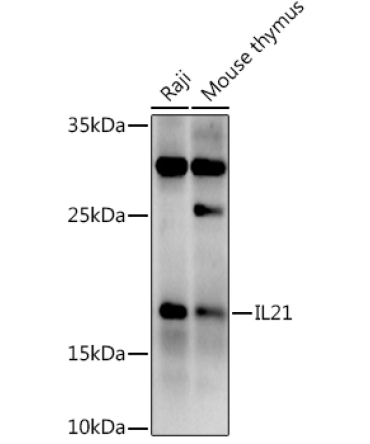 IL21 Rabbit Polyclonal Antibody