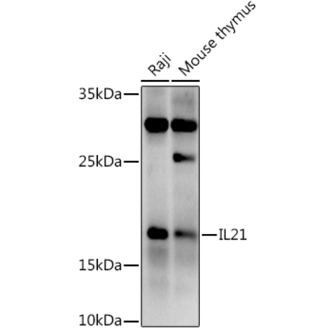 IL21 Rabbit Polyclonal Antibody