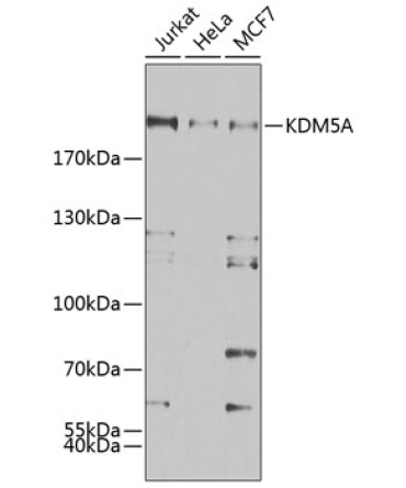 KDM5A Rabbit Polyclonal Antibody