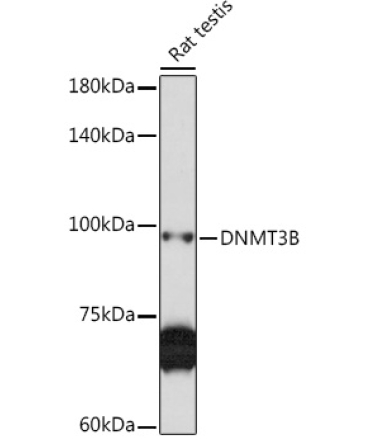 DNMT3B Rabbit Polyclonal Antibody