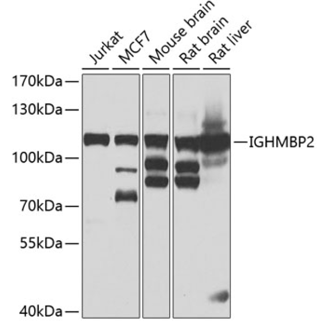 IGHMBP2 Rabbit Polyclonal Antibody