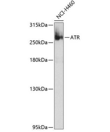 ATR Rabbit Polyclonal Antibody