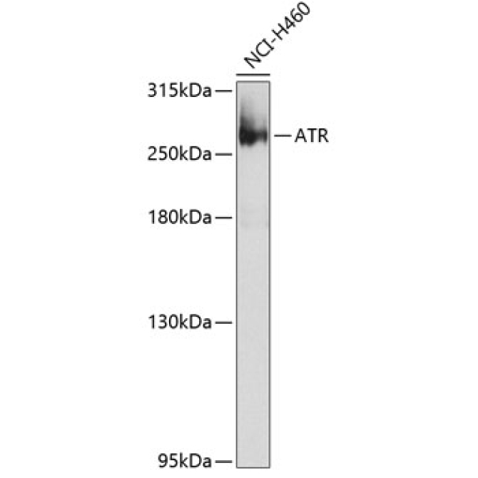 ATR Rabbit Polyclonal Antibody