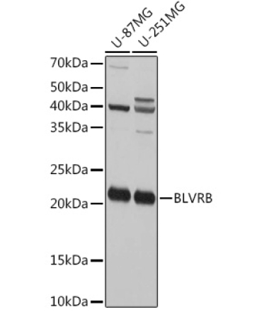 BLVRB Rabbit Polyclonal Antibody