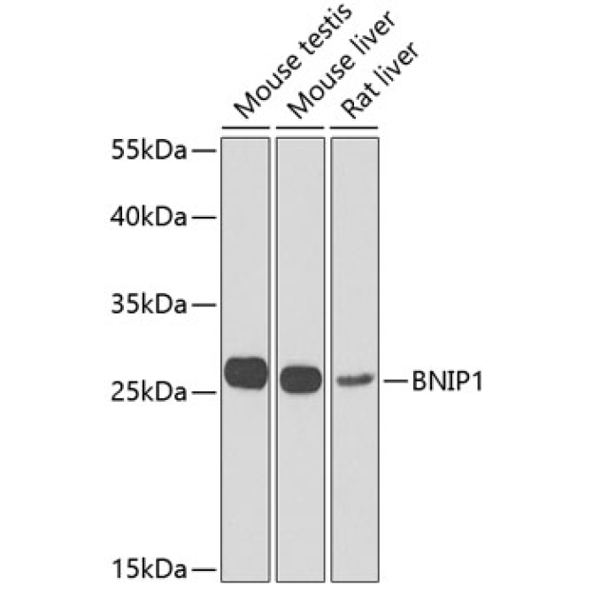 BNIP1 Rabbit Polyclonal Antibody