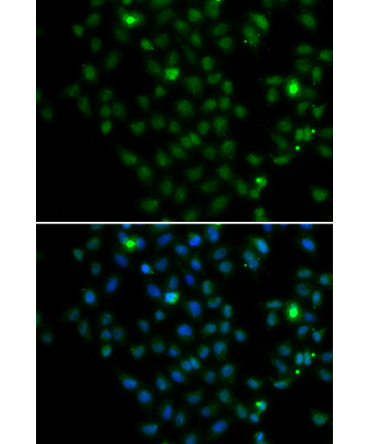 LMO4 Rabbit Polyclonal Antibody