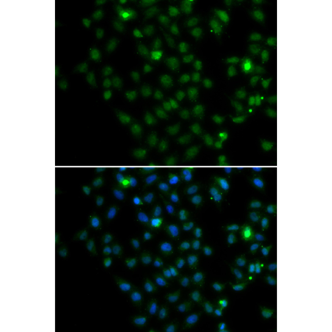 LMO4 Rabbit Polyclonal Antibody