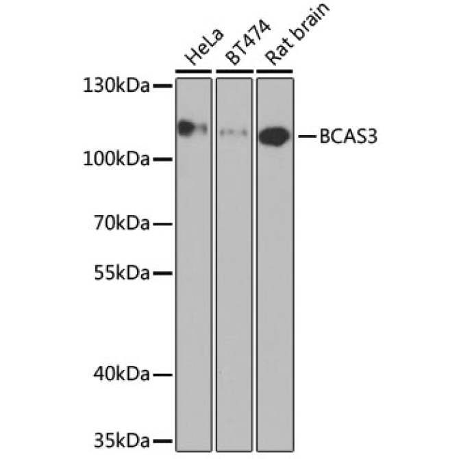 BCAS3 Rabbit Polyclonal Antibody