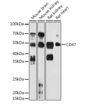 CD47 Rabbit Polyclonal Antibody