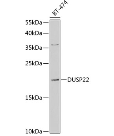 DUSP22 Rabbit Polyclonal Antibody