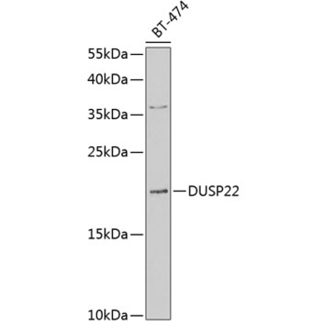 DUSP22 Rabbit Polyclonal Antibody