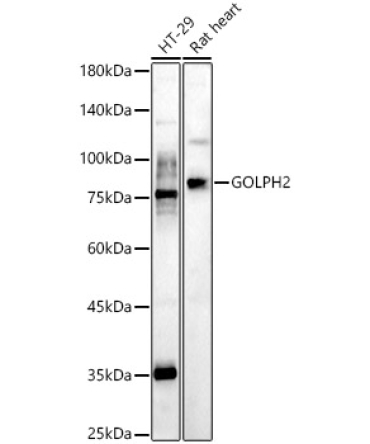 GOLPH2 Rabbit Polyclonal Antibody