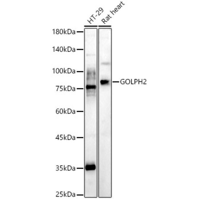 GOLPH2 Rabbit Polyclonal Antibody