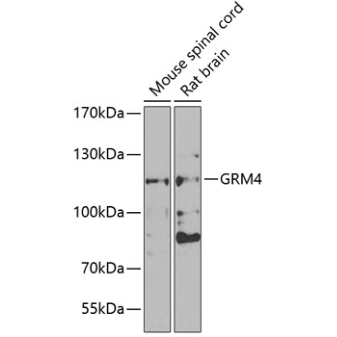GRM4 Rabbit Polyclonal Antibody