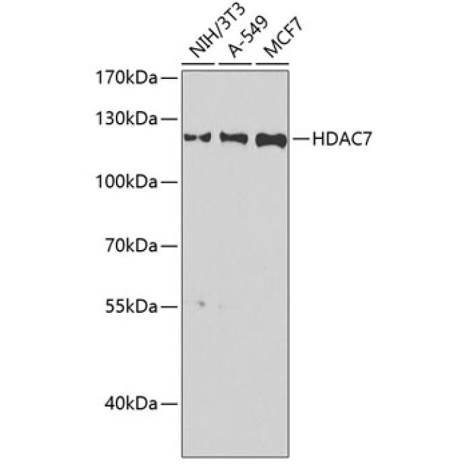 HDAC7 Rabbit Polyclonal Antibody