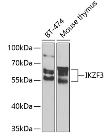 IKZF3 Rabbit Polyclonal Antibody