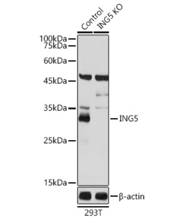 ING5 Rabbit Polyclonal Antibody [KO Validated]