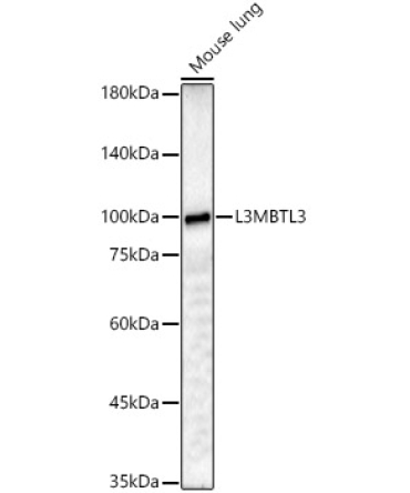 L3MBTL3 Rabbit Polyclonal Antibody