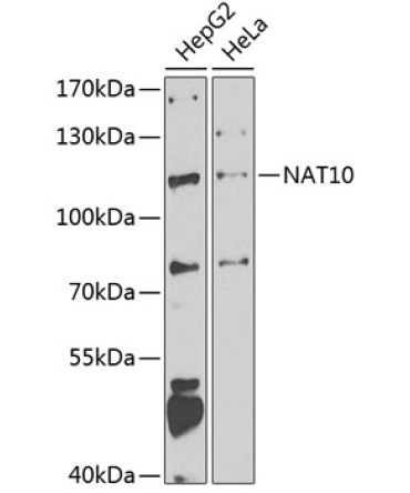 NAT10 Rabbit Polyclonal Antibody