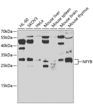 NFYB Rabbit Polyclonal Antibody