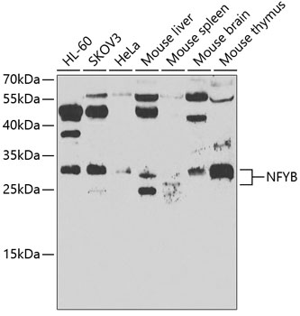 NFYB Rabbit Polyclonal Antibody