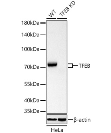 TFEB Rabbit Polyclonal Antibody [KD Validated]