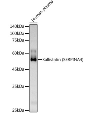 Kallistatin (SERPINA4) Rabbit Polyclonal Antibody