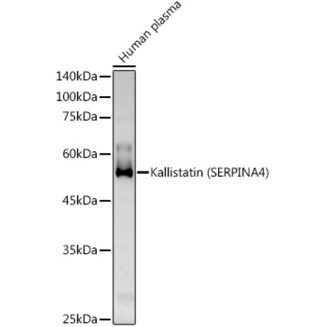 Kallistatin (SERPINA4) Rabbit Polyclonal Antibody