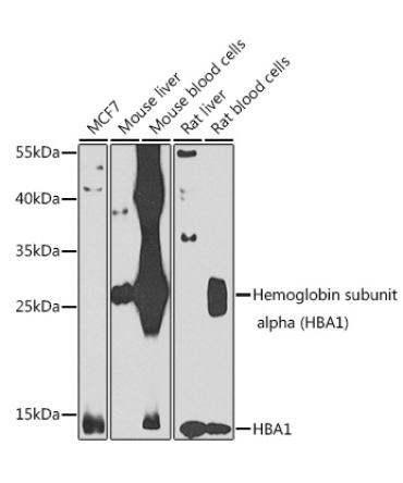 Hemoglobin subunit alpha (HBA1) Rabbit Polyclonal Antibody