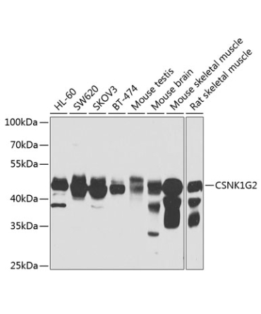 CSNK1G2 Rabbit Polyclonal Antibody
