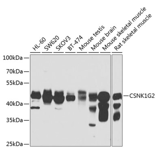 CSNK1G2 Rabbit Polyclonal Antibody