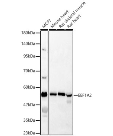 EEF1A2 Rabbit Polyclonal Antibody