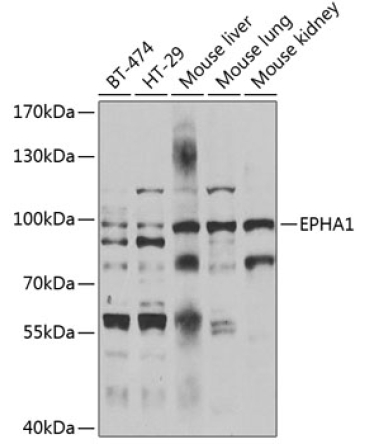 EPHA1 Rabbit Polyclonal Antibody