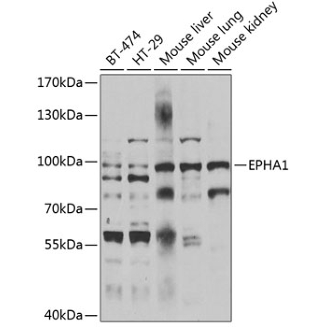 EPHA1 Rabbit Polyclonal Antibody
