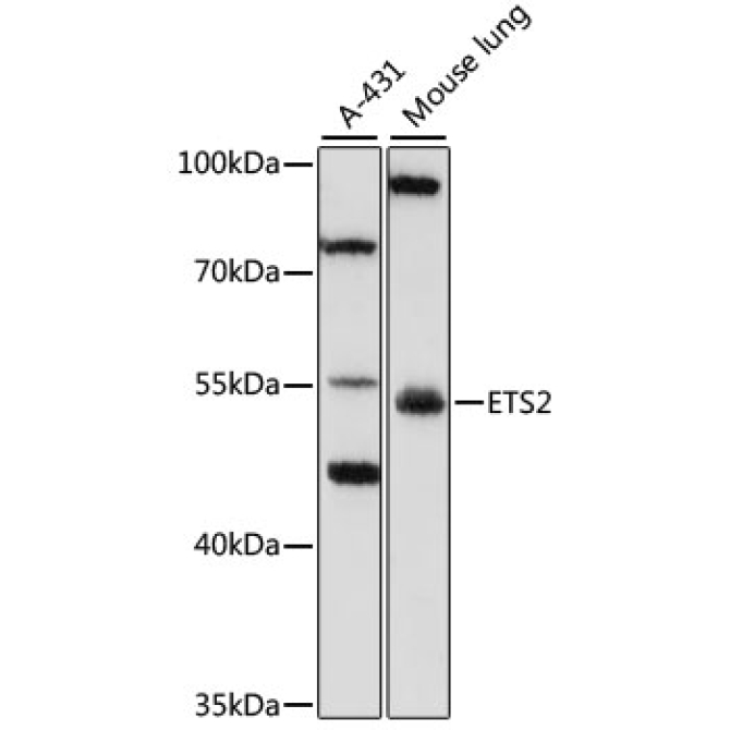 ETS2 Rabbit Polyclonal Antibody