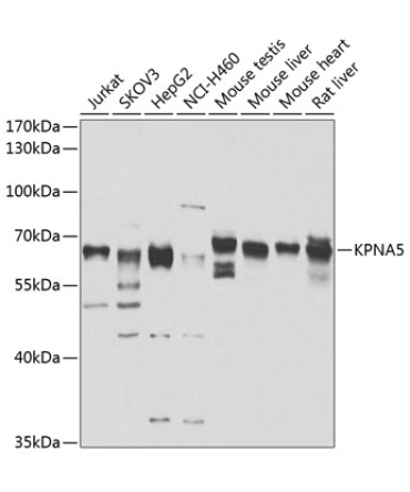 KPNA5 Rabbit Polyclonal Antibody