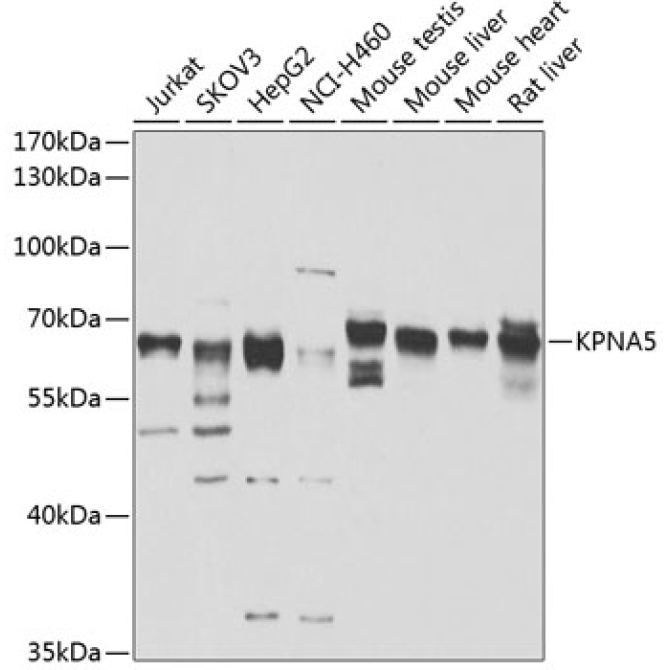 KPNA5 Rabbit Polyclonal Antibody