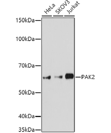 PAK2 Rabbit Polyclonal Antibody