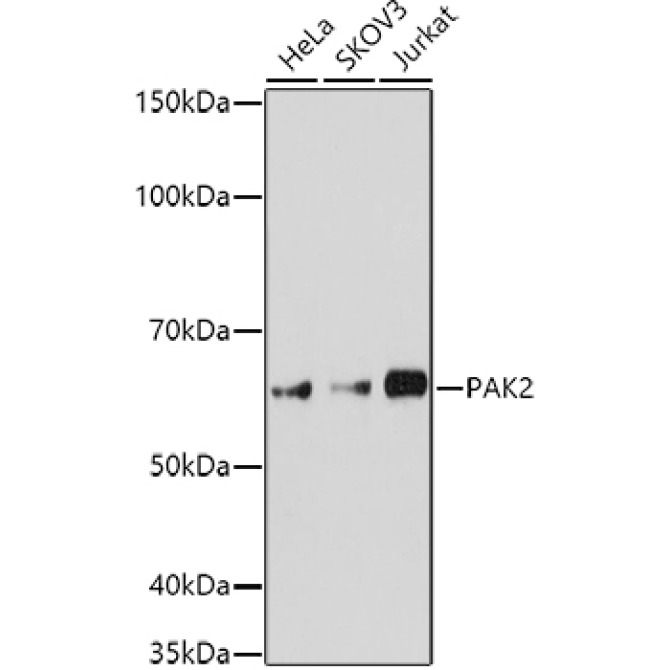 PAK2 Rabbit Polyclonal Antibody