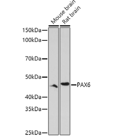 PAX6 Rabbit Polyclonal Antibody