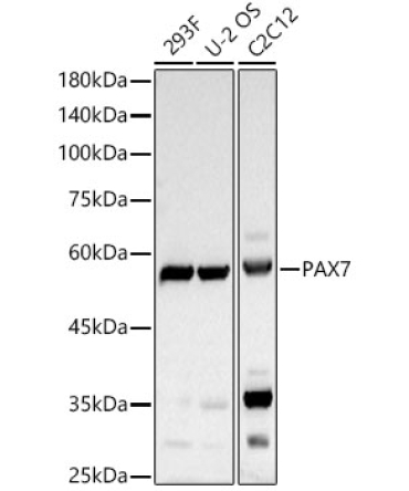PAX7 Rabbit Polyclonal Antibody
