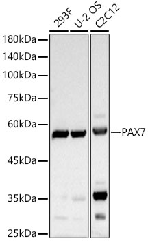 PAX7 Rabbit Polyclonal Antibody
