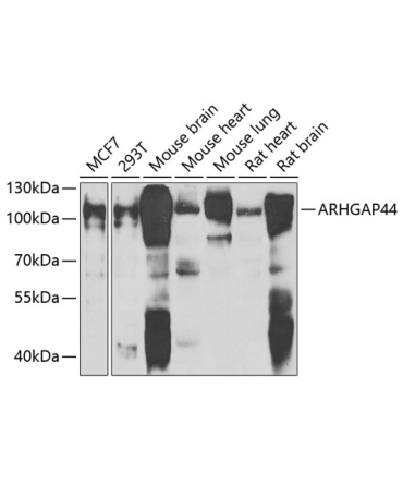 ARHGAP44 Rabbit Polyclonal Antibody
