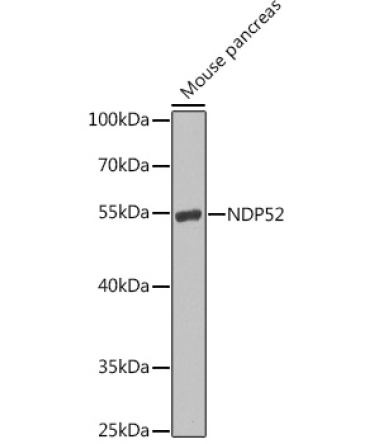 NDP52 Rabbit Polyclonal Antibody