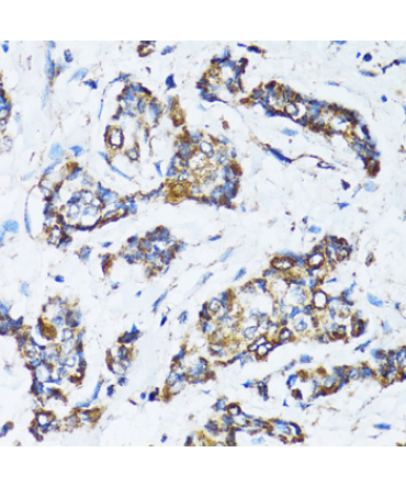 ATG7 Rabbit Polyclonal Antibody